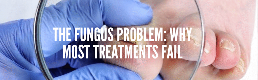 The Fungus Problem: Why Most Treatments Fail